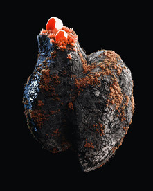 C4D 模型 长满微生物的肺
