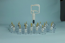 真空拔罐器中式疗法