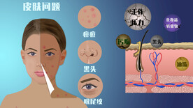 皮肤问题手绘插画设计