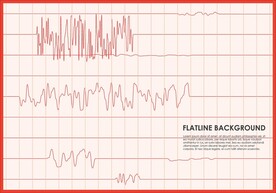 曲线心电图背景图片