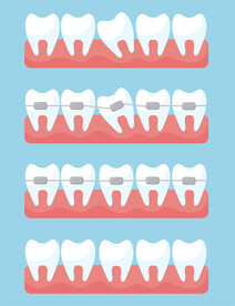牙齿 口腔 医科       