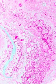 粉红色水泡不规则背景