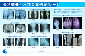 骨科部分手术项目案例展示