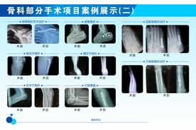 骨科部分手术项目案例展示
