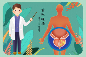 前列腺癌