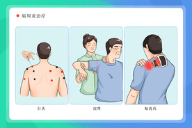 肩周炎治疗