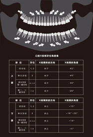医院放射科口腔X投照牙位角度表