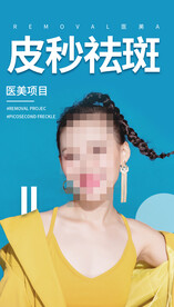 医美皮秒祛斑