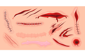 伤口插画