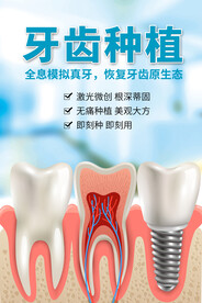 牙齿种植海报