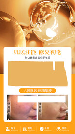 次抛