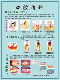 根管治疗口腔内科展板