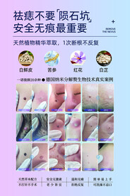 美容美体祛疣宣传海报