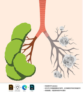 肺部结构与病毒感染示意图