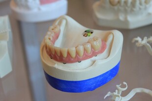 牙齿模型展示