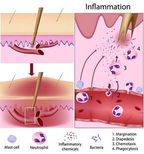皮肤炎症机制示意图