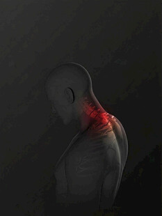 颈椎疼痛示意图y