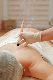 中医艾灸理疗场景