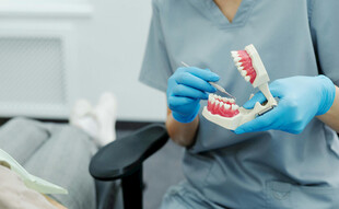 牙医手持牙齿模型