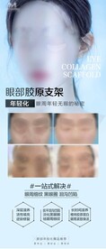医美眼部年轻化品项宣传海报展架