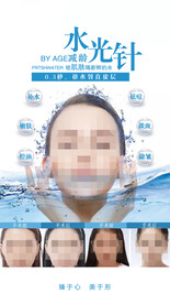 水光针
