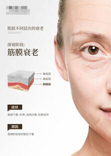 眼部抗衰展示