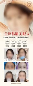 医美双眼皮宣传海报活动案例展架