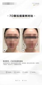 7D聚拉提