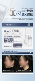 5GMAX天使光雕