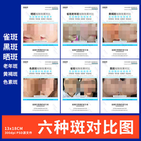 祛斑对比图 水光 面部管理