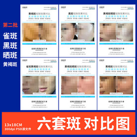 祛斑对比图 水光 面部管理