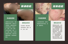 痘痘肌